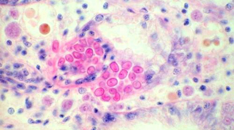 Haplosporidium nelsoni